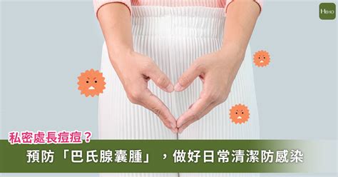 陰部生倉|驚！摸到陰唇長痘痘 原來是「它」堵塞引發感染化膿 